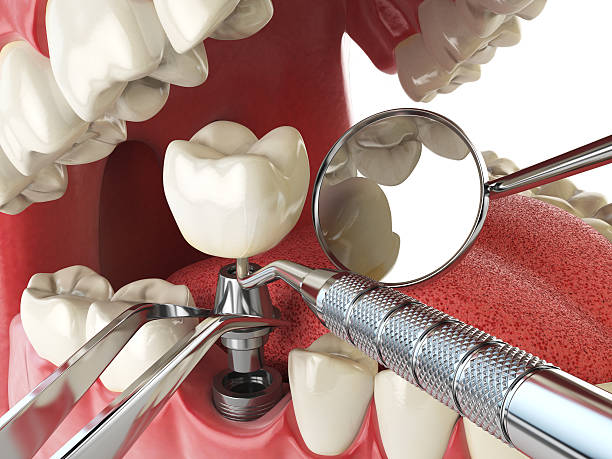 Best Orthodontic Emergency Dentist in Woodstock, GA